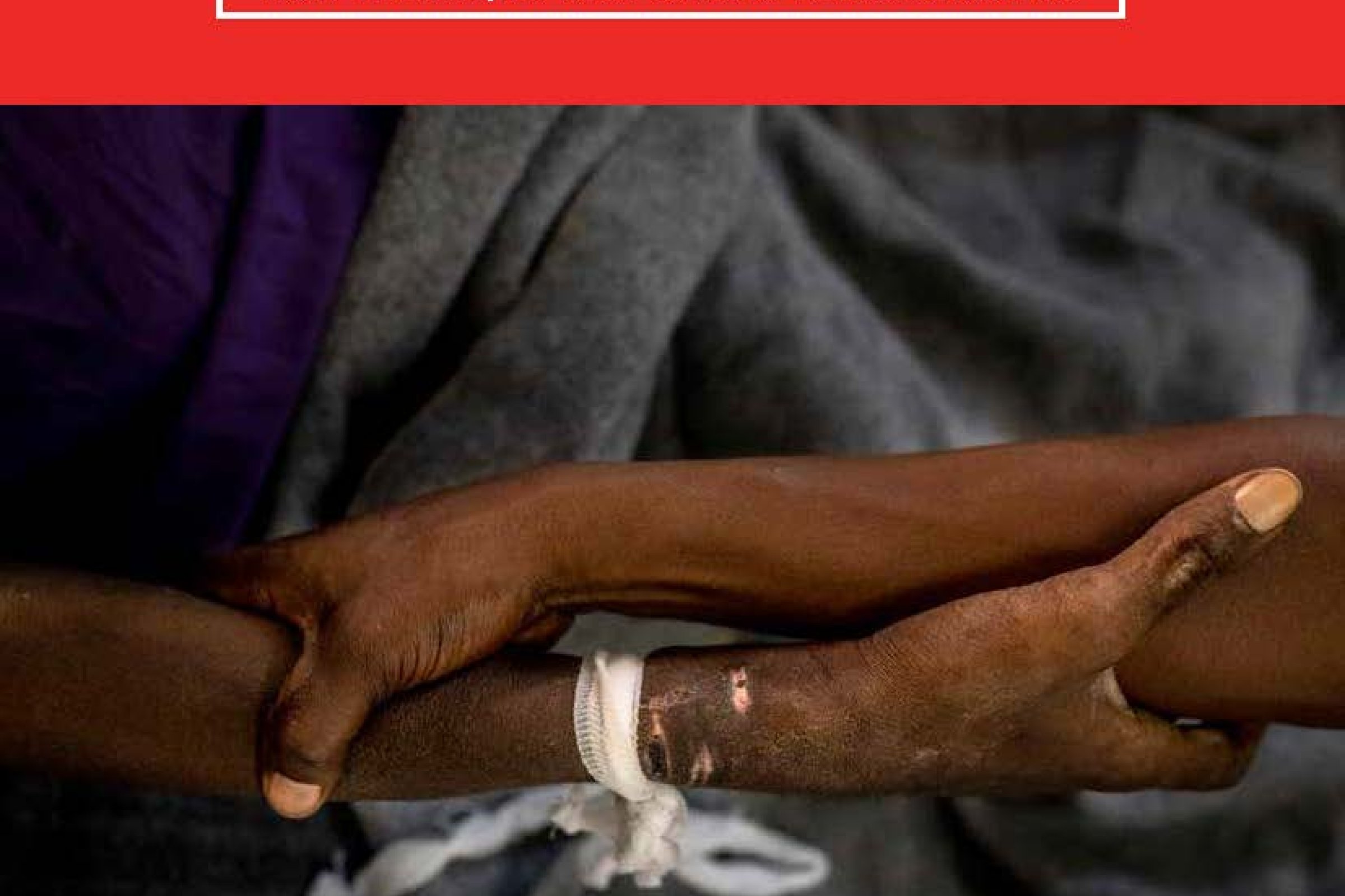 Burden sharing or burden shifting? How the HIV/TB response is being derailed