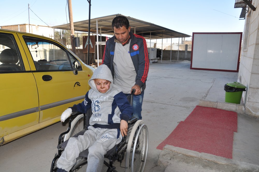 Alaan a young child injured by a landmine comes into Kobani hospital for a check up