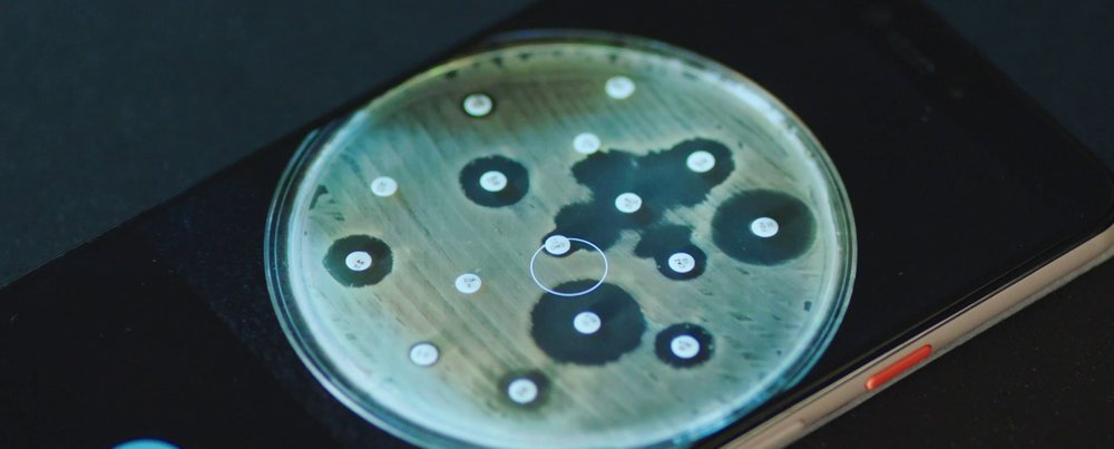 A person holds a phone with the Antibiogo application open and displays a close-up of an antibiogram. (December, 2019).