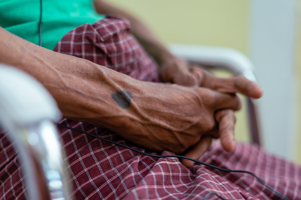 Heart tattoo inked hands of an HIV/hepatitis C co-infected patient during an interview with MSF.