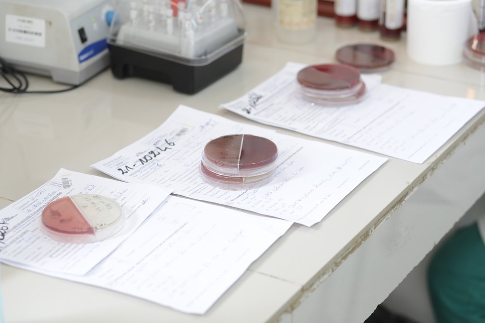 Three samples from 3 patients plated on culture media to identify bacteria in the CSREF laboratory in Koutiala, Mali. (October, 2021).