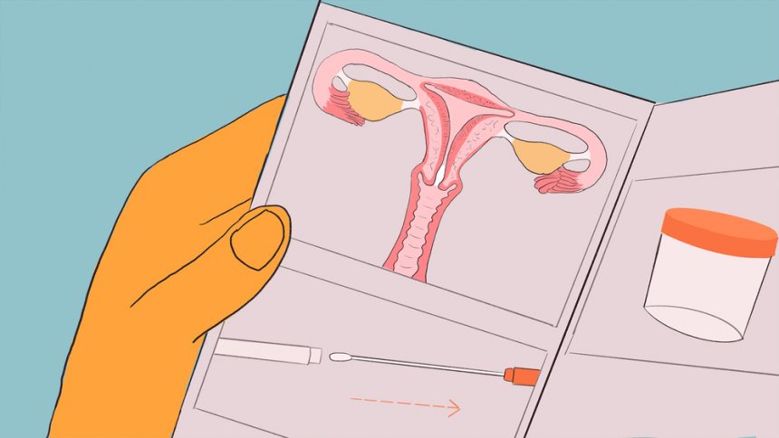 Illustration of a woman holding a “how-to” guide to self-swabbing for human papillomavirus as a screening measure to prevent cervical cancer.
