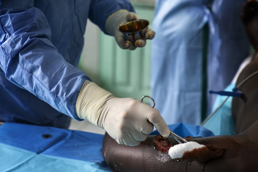 MSF surgeons provided care to Paul, who was was attacked on the road by armed men who tortured him and shot him five times. He survived his wounds and was treated at St Mary Hospital in Bamenda, North-West Cameroon. March 2020. 