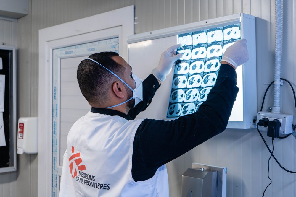 Dr Abdu Samya Bashagha checking X-ray scan of a patient in Abu Sitta Hospital where MSF is running TB support activities. (March, 2022).
