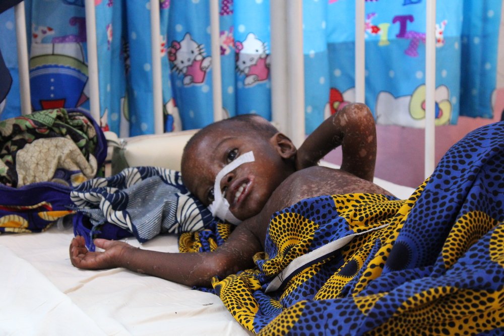 “My two children suffered from measles so we brought them to the hospital, where they gave them drugs and sent us home,&quot; said Halima mother of child being treated in the therapeutic feeding center in MSF operated by MSF in Anka hospital Zamfara.