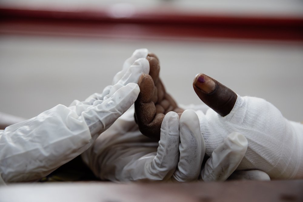 France practices exercises to regain motion at the physiotherapy department of MSF’s SICA Hospital on 2nd of February 2021, in Bangui, Central African Republic.
