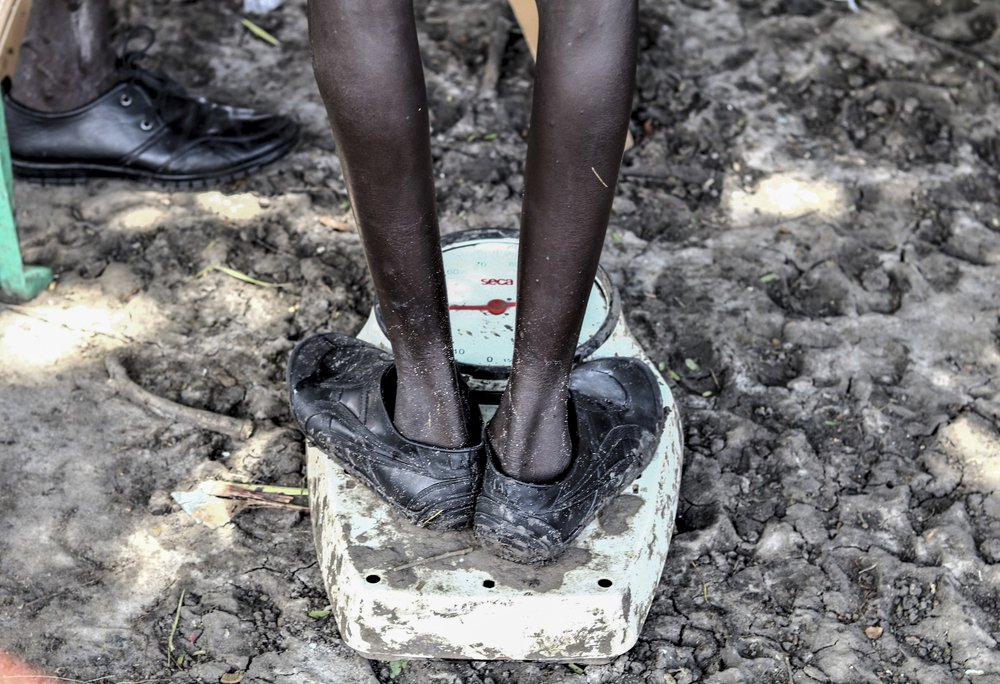 A boy measuring his weight at MSF’s clinic in Lanyeri payam. An MSF (Médecins Sans Frontières) mobile clinic brings life-saving medical care to Lanyeri after the flooding has made the roads impassable.