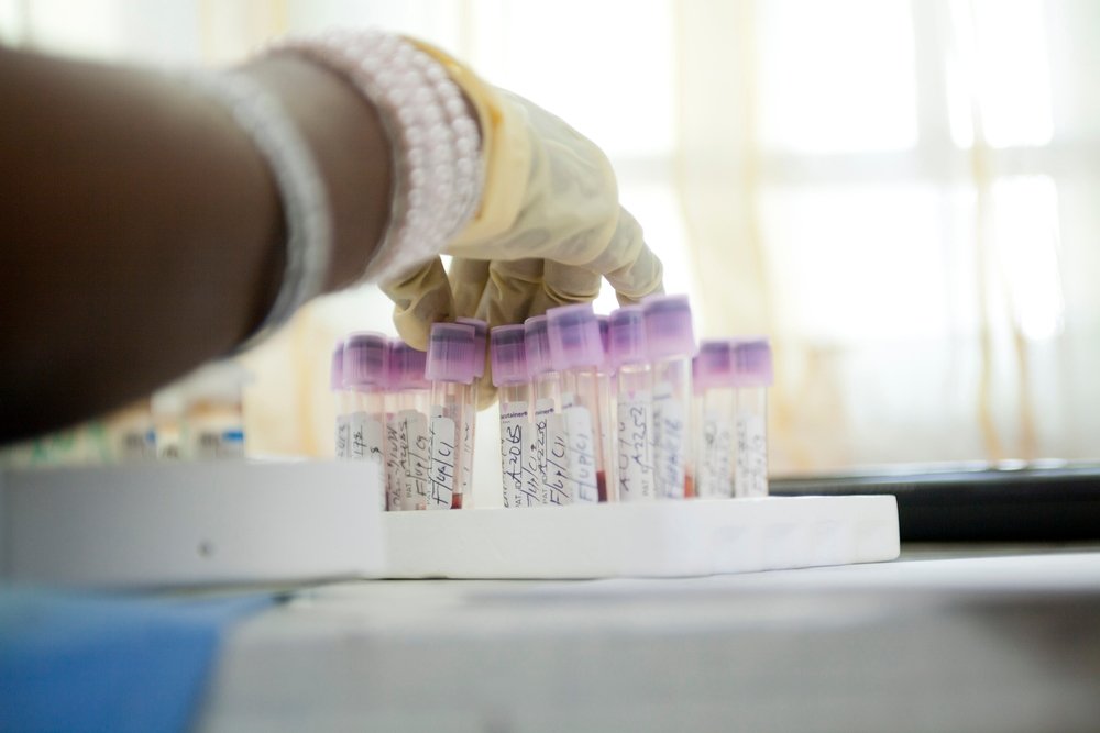 A lab technician in the MSF Lab in Anka, where they measure the lead levels in the blood. (April, 2012),