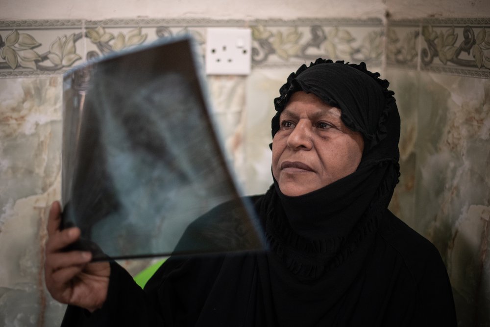 Hameeda, 65,  looks at an x-ray of her lungs. Hameeda, photographed in her home, is Iraq’s first patient to be cured with the new oral treatment for multidrug-resistant tuberculosis. 