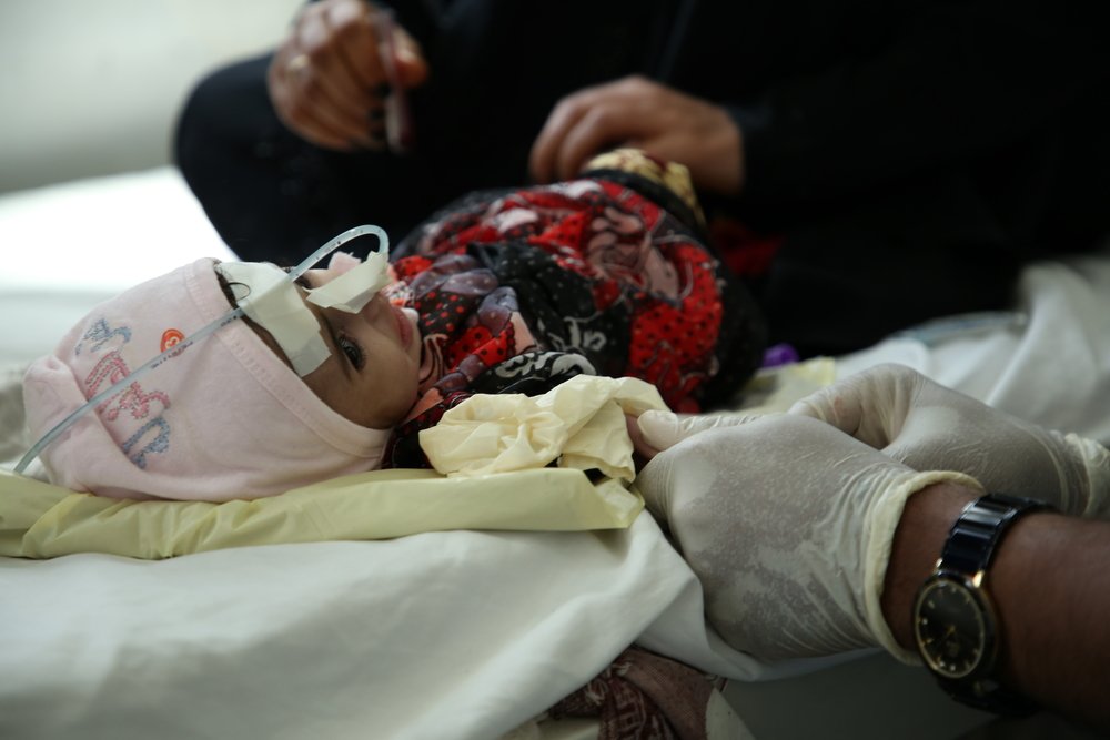 An infant being treated at the MSF mother and child hospital in Houban, Taiz