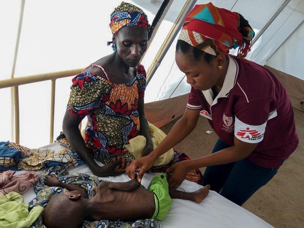 MSF medical staff member attending to a severely malnourished child in Borno State. 
