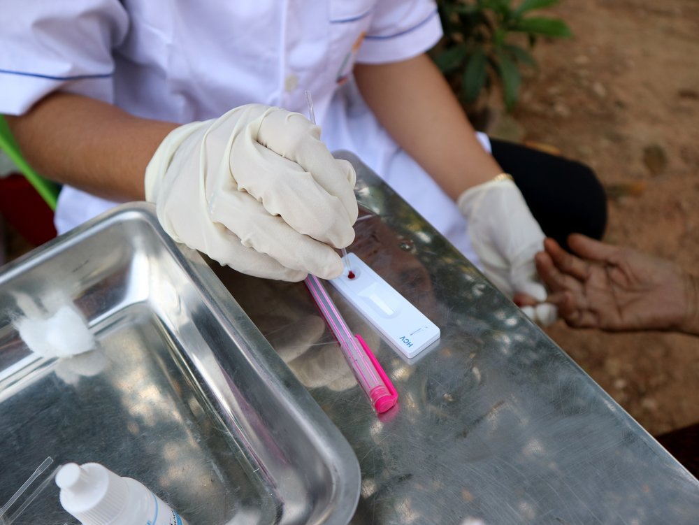 The blood sample of a villager is tested for Hepatitis C during a morning of active case finding in a village in Moung Ruessei district in Cambodia. Active case finding helps identify patients with Hepatitis C before symptoms develop. 2019.